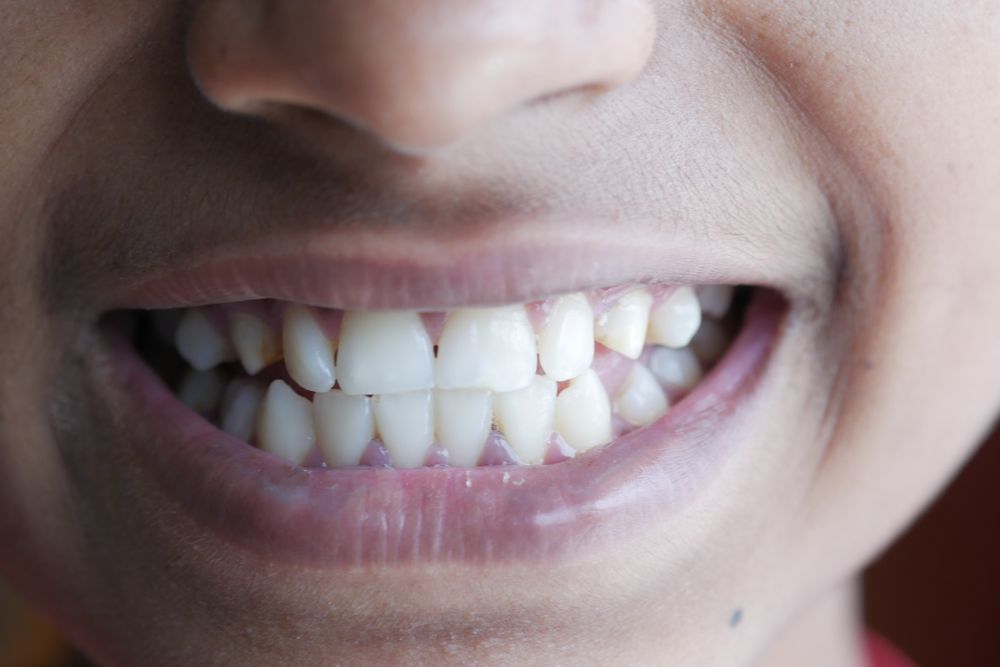 A close-up of a healthy, confident smile